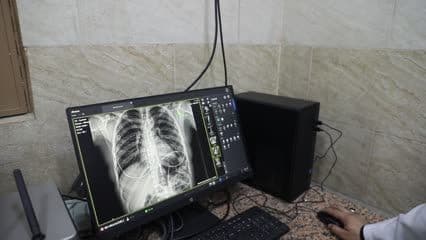 مستشفى بعقوبة العام , قسم الاشعة